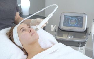 RF Microneedling
